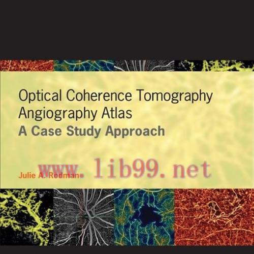[AME]Optical Coherence Tomography Angiography Atlas (Original PDF)