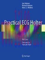 [PDF]Practical ECG Holter: 100 Cases