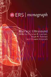 [AME]ERS Monograph 79: Thoracic Ultrasound (PDF)
