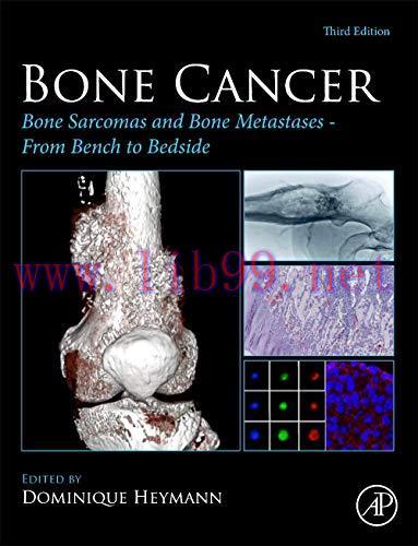 [AME]Bone Cancer: Bone Sarcomas and Bone Metastases - From_ Bench to Bedside, 3rd Edition (Orig...
