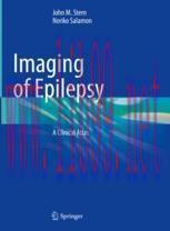 [PDF]Imaging of Epilepsy: A Clinical Atlas