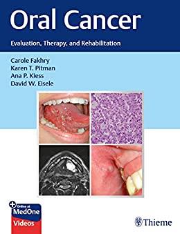 Oral Cancer Evaluation, Therapy, and Rehabilitation PDF+VIDEOS