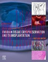 [PDF]Principles and Practice of Ovarian Tissue Cryopreservation and Transplantation