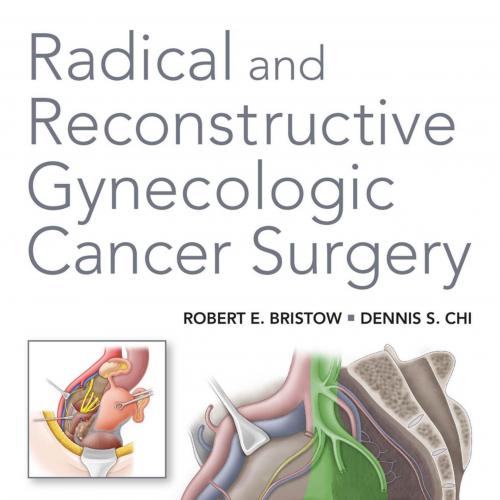 Radical and Reconstructive Gynecologic Cancer Surgery