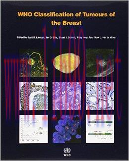 [AME]WHO Classification of Tumours of the Breast (IARC WHO Classification of Tumours) (Retail P...
