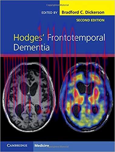 [PDF]Hodges’ Frontotemporal Dementia, Second Edition
