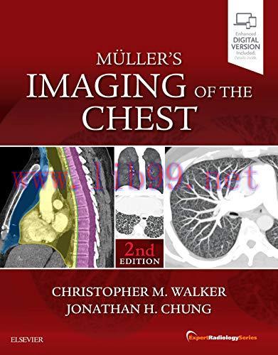 [AME]Muller’s Imaging of the Chest: Expert Radiology Series, 2ed (PDF)