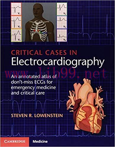 [PDF]Critical Cases in Electrocardiography