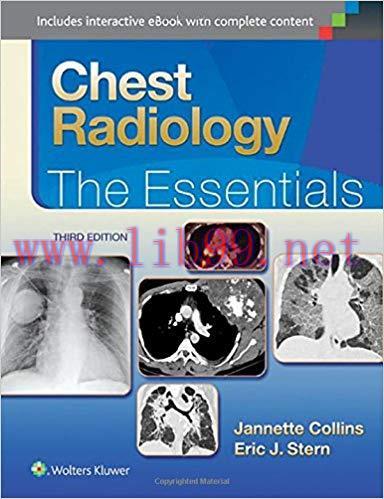 [CHM]Chest Radiology - The Essentials, 3rd Edition