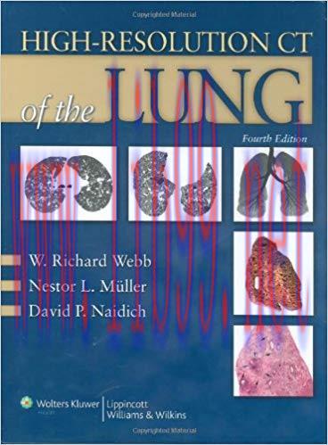 [PDF]High-Resolution CT of the Lung, 4th Edition
