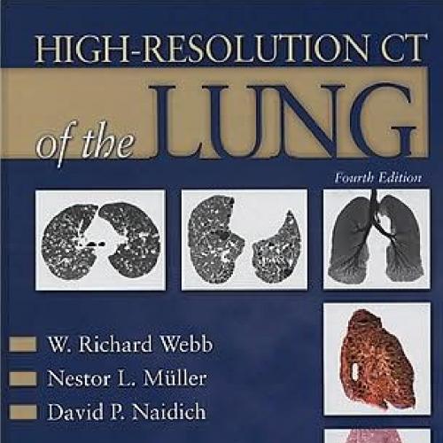 High-Resolution CT of the Lung, 4th Edition