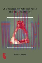 [AME]A Treatise on Otoslerosis and its Treatment (Original PDF)