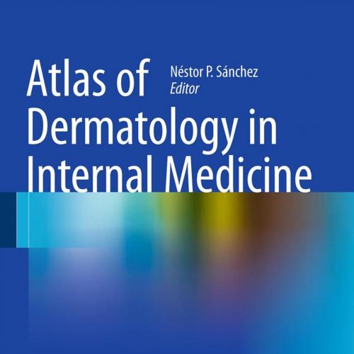Atlas of Dermatology in Internal Medicine - Nestor P. Sanchez