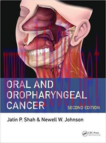 [PDF]Oral and Oropharyngeal Cancer