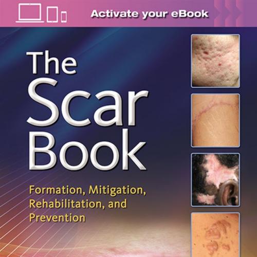 The Scar Book Formation, Mitigation, Rehabilitation and Prevention - Original PDF