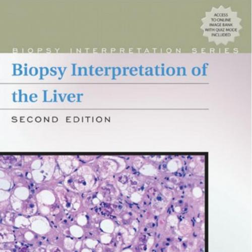 Biopsy Interpretation of the Liver, 2nd Edition