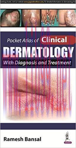 [PDF]Pocket Atlas of Clinical Dermatology with Diagnosis and Treatment