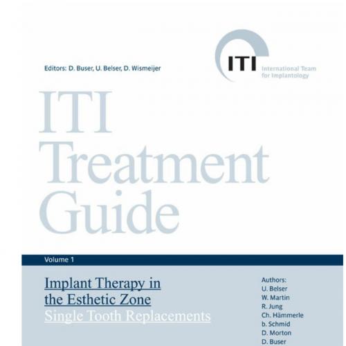ITI Treatment Guide 1