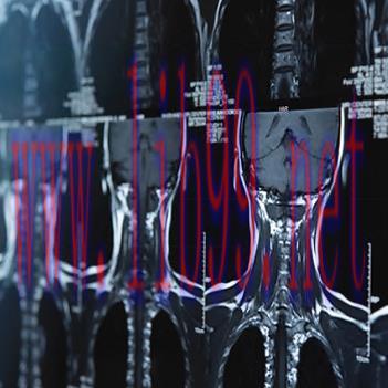 [AME]Neurosurgery – A Comprehensive Review 2021 (CME VIDEOS)