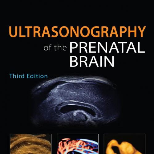 Ultrasonography of the Prenatal Brain 3rd - Ilan E. Timor-Tritsch, MD