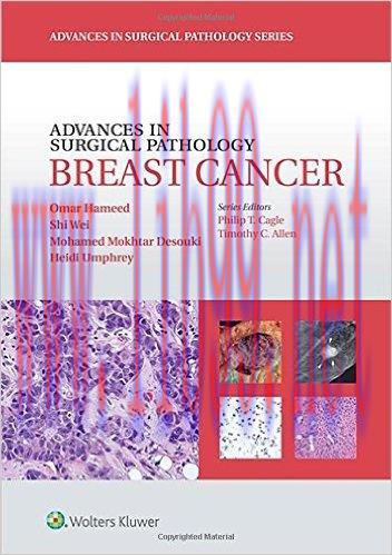 [AME]Advances in Surgical Pathology: Breast Cancer (EPUB)