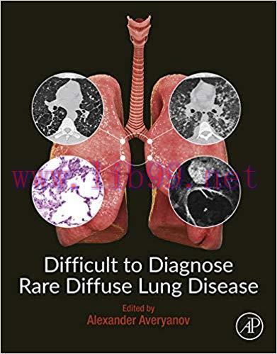 [PDF]Difficult to Diagnose Rare Diffuse Lung Disease
