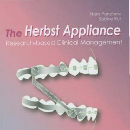 Herbst Appliance Research-Based Clinical Management, The