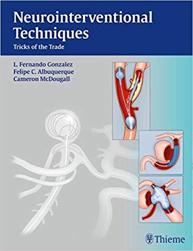 Neurointerventional Techniques - Tricks of the Trade