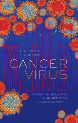[AME]Cancer Virus: The discovery of the Epstein-Barr Virus