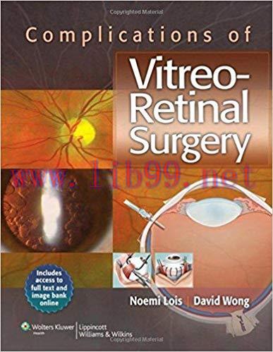 [PDF]Complications of Vitreo-Retinal Surgery