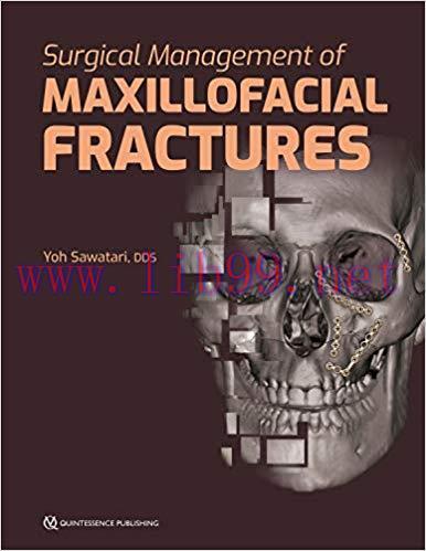 [PDF]Surgical Management of Maxillofacial Fractures