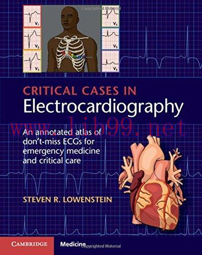 [FOX-Ebook]Critical Cases in Electrocardiography: An Annotated Atlas of Don't-Miss ECGs for Eme...