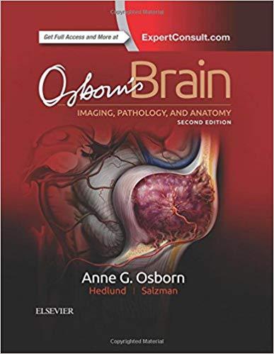 Osborn’s Brain 2nd Edition