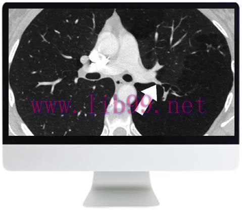 [AME]ARRS Basic Chest Imaging 2019 (CME VIDEOS)