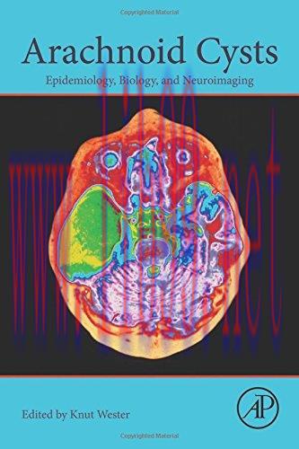[AME]Arachnoid Cysts: Epidemiology, Biology, and Neuroimaging (EPUB)