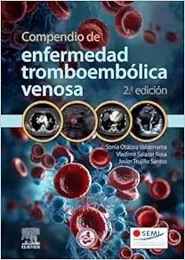 [AME]Compendio de enfermedad tromboembólica venosa, 2.ª edición (Original PDF)