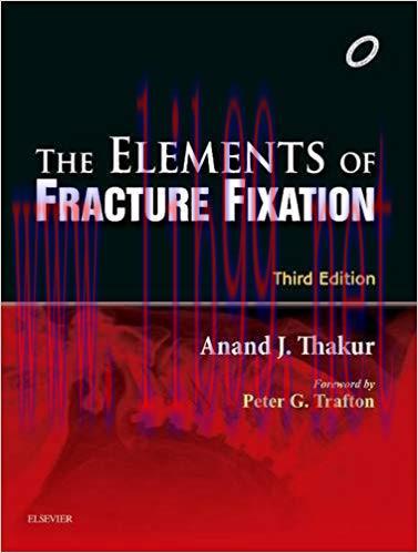 [PDF]Elements of Fracture Fixation
