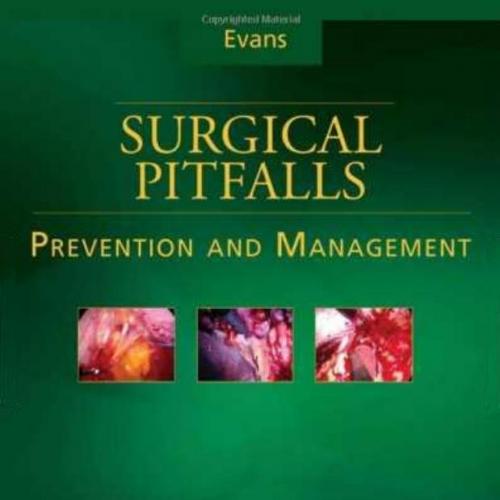 Surgical pitfalls _ prevention and management