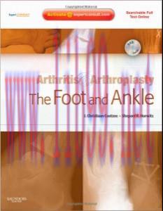 [AME]Arthritis and Arthroplasty: The Foot and Ankle: Expert Consult - Online, Print and DVD, 1e...