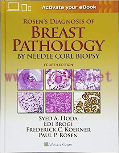 [CHM]Rosen’s Diagnosis of Breast Pathology by Needle Core Biopsy 4th Edition