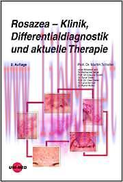[AME]Rosazea – Klinik, Differentialdiagnostik und aktuelle Therapie (UNI-MED Science), 2nd Edit...