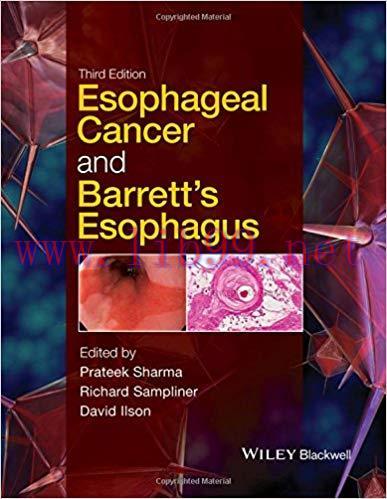 [PDF]Esophageal Cancer and Barrett’s Esophagus, 3rd Edition