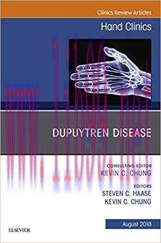 [PDF]Dupuytren Disease