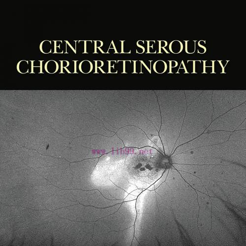[AME]Central Serous Chorioretinopathy (Original PDF)