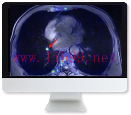 [AME]Applying Recent Advances in PET to Clinical Practice 2020 (CME VIDEOS)
