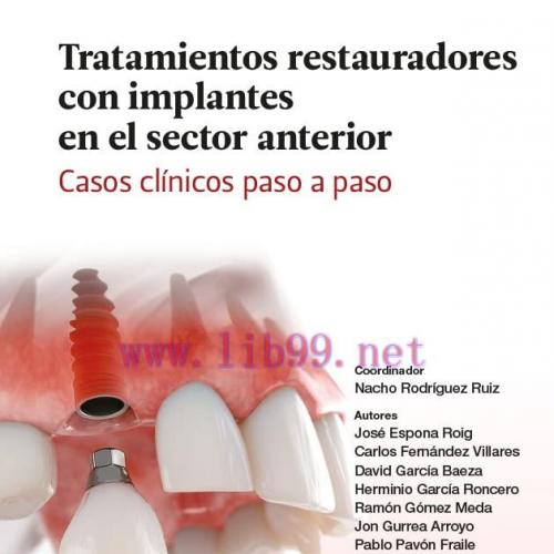 [AME]Tratamientos restauradores con implantes en el sector anterior. Casos clínicos paso a paso...