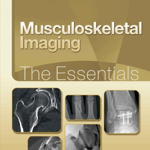 Musculoskeletal Imaging_ The Essentials