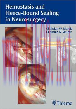 [AME]Hemostasis and Fleece-Bound Sealing in Neurosurgery