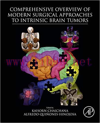[PDF]Comprehensive Overview of Modern Surgical Approaches to Intrinsic BRAIN TUMORS