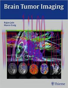 [AME]Brain Tumor Imaging
